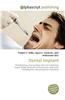 Dental Implant