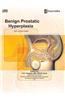 Benign Prostatic Hyperplasia