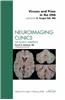 Viruses and Prions in the CNS, an Issue of Neuroimaging Clinics