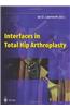 Interfaces in Total Hip Arthroplasty