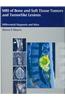 MRI of Bone and Soft Tissue Tumors and Tumorlike Lesions: Differential Diagnosis and Atlas