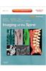 Imaging of the Spine