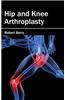 Hip and Knee Arthroplasty