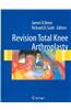Revision Total Knee Arthroplasty