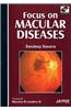 Focus on Macular Diseases