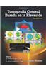 Tomografia Corneal Basada en la Elevacion