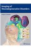 Imaging of Neurodegenerative Disorders