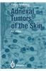 Adnexal Tumors of the Skin