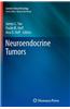 Neuroendocrine Tumors