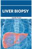 Liver Biopsy