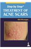 Step by Step Treatment of Acne Scars