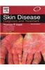 Skin Desease: Diagnosis And Treatment