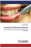 Loading of Dental Implants