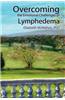 Overcoming the Emotional Challenges of Lymphedema