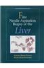 Fine Needle Aspiration Biopsy of the Liver