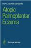 Atopic Palmoplantar Eczema