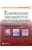 Tumorigenic Melanocytic Proliferations