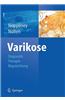 Diagnostik und Therapie der Varikose