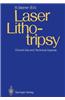 Laser Lithotripsy