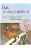 Hair Transplantation