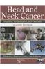 Head and Neck Cancer