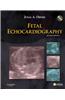 Fetal Echocardiography