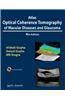 Atlas Optical Coherence Tomography of Macular Diseases and Glaucoma