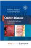 Crohn's Disease