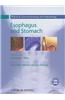 Esophagus and Stomach: Practical Gastroenterology and Hepatology