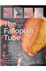 Fallopian Tube