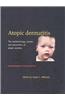 Atopic Dermatitis: The Epidemiology, Causes and Prevention of Atopic Eczema