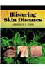 Blistering Skin Diseases