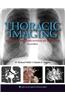 Thoracic Imaging: Pulmonary and Cardiovascular Radiology [With Free Web Access]