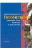 Modern Management of Endometriosis