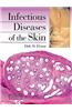 Infectious Diseases of the Skin