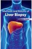 Methods and Results of Liver Biopsy