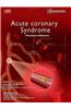 Acute Coronary Syndrome