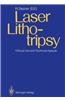 Laser Lithotripsy