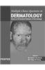 Mcq In Dermatology