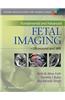 Fundamental and Advanced Fetal Imaging: Ultrasound and MRI