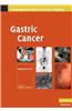 Gastric Cancer