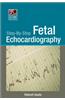 Step-by-Step Fetal Echocardiography