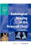 Radiological Imaging of the Neonatal Chest