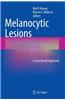 Melanocytic Lesions