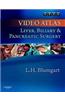 Video Atlas: Liver, Biliary & Pancreatic Surgery