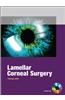 Lamellar Corneal Surgery