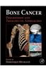 Bone Cancer: Progression and Therapeutic Approaches