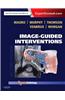 Image-Guided Interventions: Expert Radiology Series (Expert Consult - Online and Print)