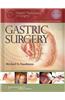 Gastric Surgery with Access Code