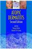 Atopic Dermatitis
